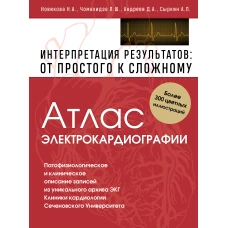 Атлас электрокардиографии. Интерпретация результатов: от простого к сложному