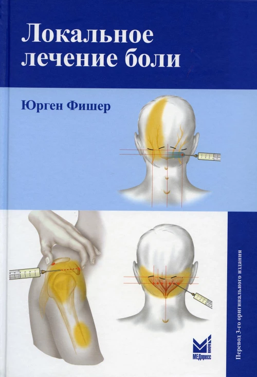 Локальное лечение боли. 9-е изд (пер.). Фишер Ю.