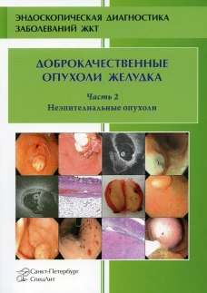 Доброкачественные опухоли желудка. Неэпителиальные опухоли. Ч. 2: Учебно-методическое пособие. Кузин М.Н., Добронец В.В., Шкалова Л.В.