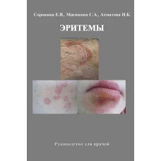 Эритемы. Руководство для врачей. Ахматова Н.К., Масюкова С.А., Сорокина Е.В.