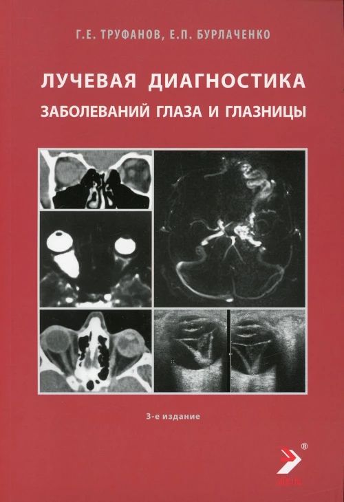 Лучевая диагностика заболеваний глаза и глазницы. 3-е изд. Труфанов Г.Е., Бурлаченко Е.П.