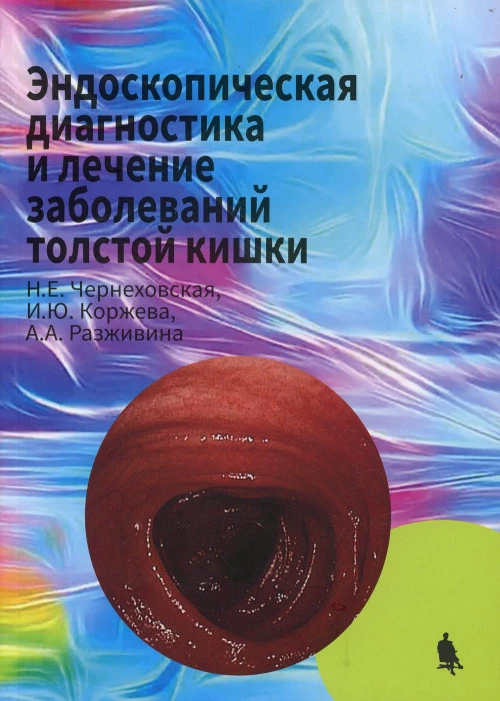 Эндоскопическая диагностика и лечение заболеваний толстой кишки. Чернеховская Н.Е., Коржева И.Ю., Разживина А. А.