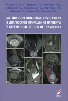 Магнитно-резонансная томография в диагностике приращения плаценты у беременных во II и III триместрах: Учебное пособие. Труфанов Г.Е., Мащенко И. А., Ефимцев А. Ю.