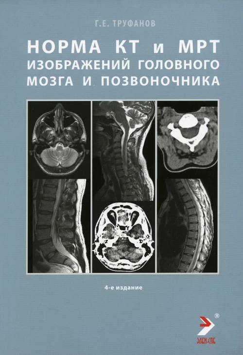 Норма КТ- и МРТ- изображений головного мозга и позвоночника: атлас изображений. 4-е изд. Труфанов Г.Е.