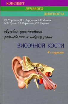Лучевая диагностика заболеваний и повреждений височной кости (Конспект лучевого диагноста). 4-е изд., перераб. и доп. Труфанов Г.Е., Дергунова Н.И., Михеев А.Е.