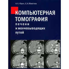 Компьютерная томография печени и желчевыводящих путей: практическое руководство. Юдин А.Л., Юматова Е.А.