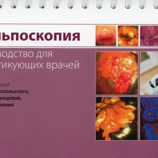 Кольпоскопия. Руководство для практикующих врачей. Под ред. Краснопольского В.И., Зароченцевой Н.В., Джиджихия Л.К.