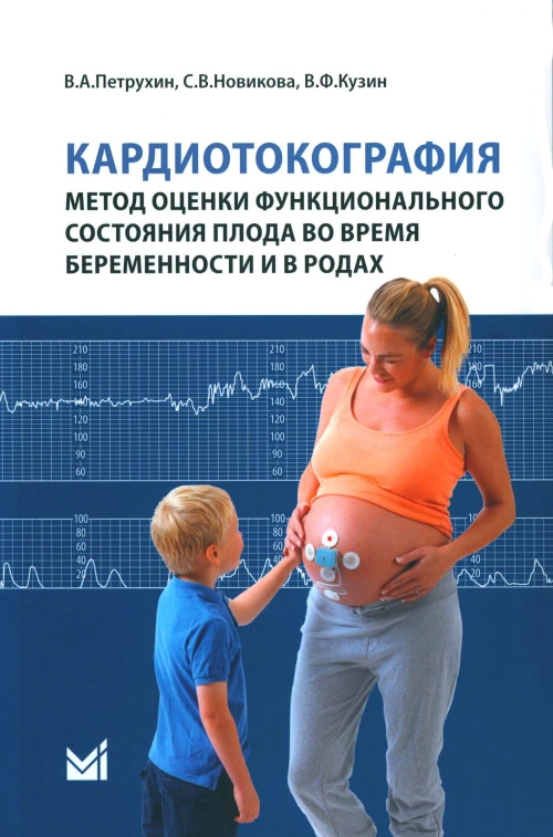 Кардиотокография - метод оценки функционального состояния плода во время беременности: Учебное пособие. 2-е изд. Петрухин В.А., Новикова С.В., Кузин В.Ф.