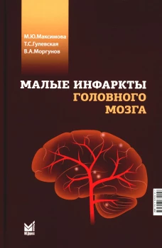 Малые инфаркты головного мозга. Гулевская Т.С., Максимова М.Ю., Моргунов В.А.