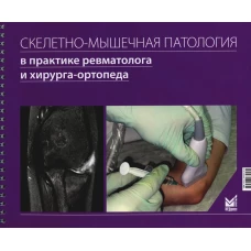 Скелетно-мышечная патология в практике ревматолога и хирурга-ортопеда: Краткое иллюстрированное руководство. Каратеев А.Е., Макаров М.А., Макаров С.А.