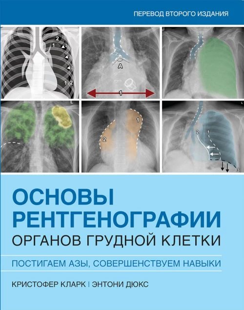 Основы рентгенографии органов грудной клетки. Кларк К., Дюкс Э.