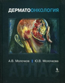Дерматоонкология. Атлас. Молочков А.В., Молочкова Ю.В.