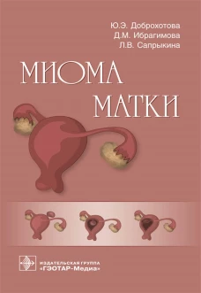 Миома матки. Доброхотова Ю.Э., Сапрыкина Л.В., Ибрагимова Д.М.