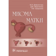 Миома матки. Доброхотова Ю.Э., Сапрыкина Л.В., Ибрагимова Д.М.