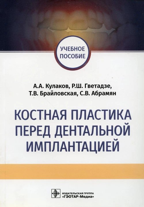 Костная пластика перед дентальной имплантацией: Учебное пособие. Гветадзе Р.Ш., Кулаков А.А., Брайловская Т.В.