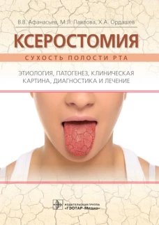 Ксеростомия (сухость полости рта). Этиология, патогенез, клиническая картина, диагностика и лечение. Афанасьев В.В., Павлова М.Л., Ордашев Х.А.