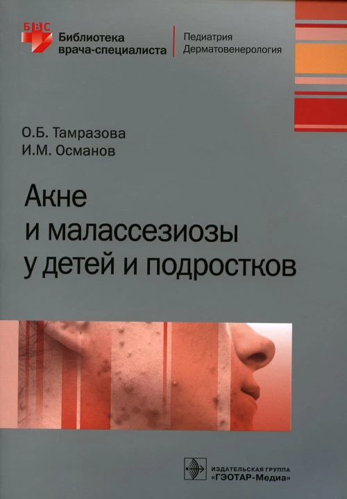 Акне и малассезиозы у детей и подростков. Османов И.М., Тамразова О.Б.