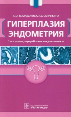 Гиперплазия эндометрия. 2-е изд., перераб. и доп. Доброхотова Ю.Э., Сапрыкина Л.В.