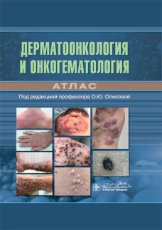 Дерматоонкология и онкогематология. Атлас. Белоусова Т.А., Вертиева Е.Ю., Грекова Е.В