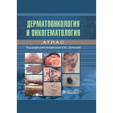 Дерматоонкология и онкогематология. Атлас. Белоусова Т.А., Вертиева Е.Ю., Грекова Е.В