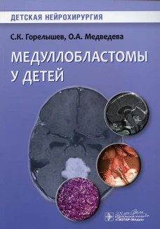 Медуллобластомы у детей. Горелышев С.К., Медведева О.А.