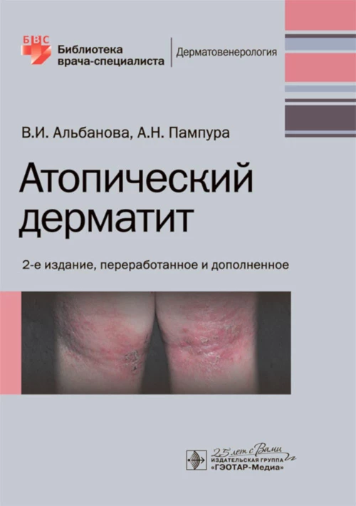 Атопический дерматит. 2-е изд., перераб. и доп. Альбанова В.И., Пампура А.Н.