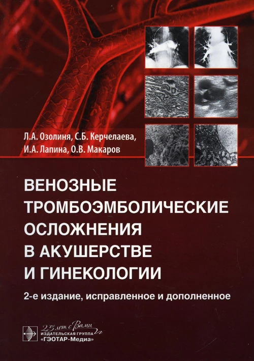 Венозные тромбоэмболические осложнения в акушерстве и гинекологии. 2-е изд., испр. и доп. Лапина И.А., Озолиня Л.А., Керчелаева С.Б.
