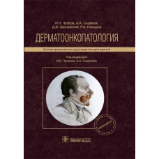 Дерматоонкопатология: иллюстрированное руководство для врачей. Заславский Д.В., Чупров И.Н., Сыдиков А.А.
