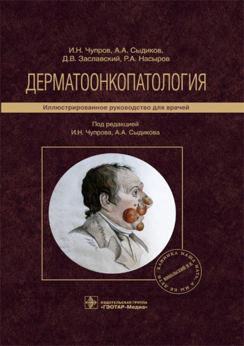 Дерматоонкопатология: иллюстрированное руководство для врачей. Заславский Д.В., Чупров И.Н., Сыдиков А.А.