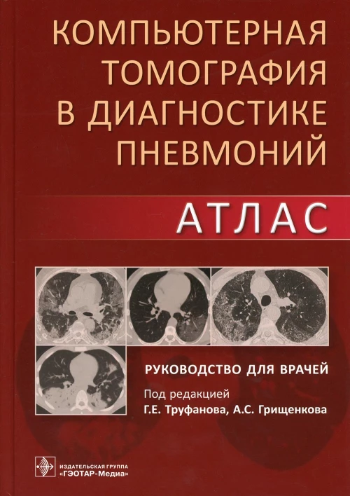 Компьютерная томография в диагностике пневмоний. Атлас: руководство для врачей. Под ред. Труфанова Г.Е., Грищенкова А.С.