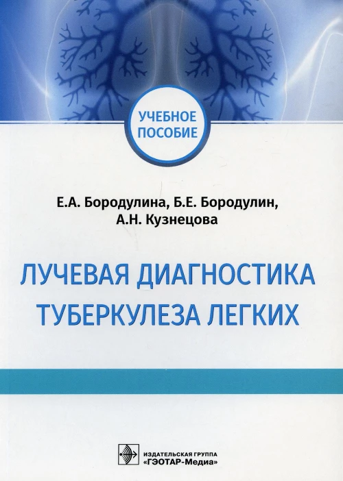 Лучевая диагностика туберкулеза легких: Учебное пособие. Бородулин Б.Е., Бородулина Е.А., Кузнецова А.Н.