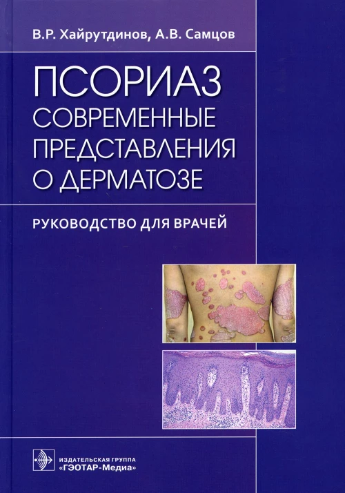 Псориаз. Современные представления о дерматозе: руководство для врачей. Самцов А.В., Хейрутдинов В.Р.