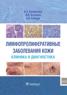 Лимфопролиферативные заболевания кожи. Клиника и диагностика. Белоусова И.Э., Самцов А.В., Казаков Д.В.