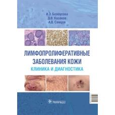 Лимфопролиферативные заболевания кожи. Клиника и диагностика. Белоусова И.Э., Самцов А.В., Казаков Д.В.