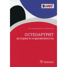 Остеоартрит. История и современность. Загородний Н.В., Минасов Т. Б.