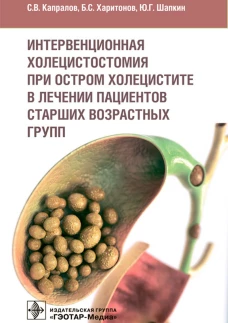Интервенционная холецистостомия при остром холецистите в лечении пациентов старших возврастных групп. Шапкин Ю. Г., Харитонов Б.С., Капралов С. В.