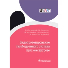 Эндопротезирование тазобедренного сустава при коксартрозе. Загородний Н.В., Колесник А.И., Каграманов С.В.