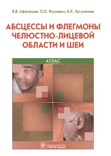 Абсцессы и флегмоны челюстно-лицевой области и шеи. Атлас: учебное пособие. Афанасьев В.В., Янушевич О.О., Ургуналиев Б.К