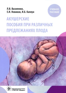 Акушерские пособия при различных предлежаниях плода: Учебное пособие. Василенко Л.В., Новиков Е.И., Каплун И.Б.