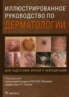 Иллюстрированное руководство по дерматологии. Для подготовки врачей к аккредитации. Под ред. Олисовой О.Ю., Теплюк Н.П.