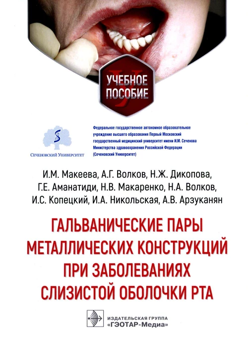 Гальванические пары металлических конструкций при заболеваниях слизистой оболочки рта: Учебное пособие. Макеева И.М., Волков А.Г., Дикопова Н.Ж.