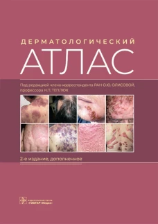 Дерматологический атлас. 2-е изд., доп. Снарская Е.С., Олисова О.Ю., Теплюк Н.П.