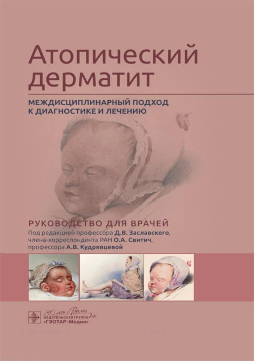 Атопический дерматит. Междисциплинарный подход к диагностике и лечению: руководство для врачей. Под ред. Заславского Д.В., Свитич О.А., Кудрявцевой А.В.