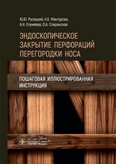 Эндоскопическое закрытие перфораций перегородки носа: пошаговая иллюстрированная инструкция. Русецкий Ю.Ю., Мантурова Н.Е., Елумеева А.Н.