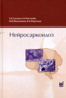 Нейросаркоидоз. Суслина З.А., Кистенев Б.А., Максимова М.Ю., Моргунов В.А.