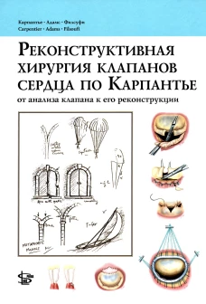 Реконструктивная хирургия клапанов сердца по Карпантье: от анализа клапана к его реконструкции. Карпантье А., Адамс Д.Г., Филсуфи Ф.