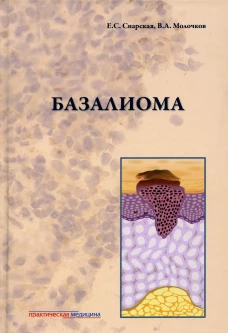 Базалиома. Молочков В.А., Снарская Е.С.