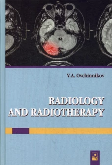 Лучевая диагностика и лучевая терапия = Radiology and radiotherapy: Учебник для студентов факультета иностранных учащихся с английским языком обучения. Овчинников В.А.