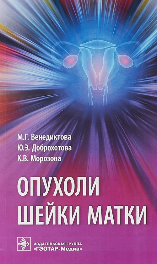 Опухоли шейки матки