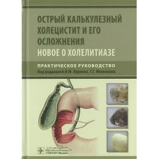 Острый калькулезный холецистит и его осложнения. Новое о холелитиазе